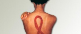 Living with AIDS